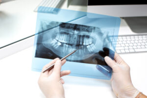 Radiologia Odontoiatrica2